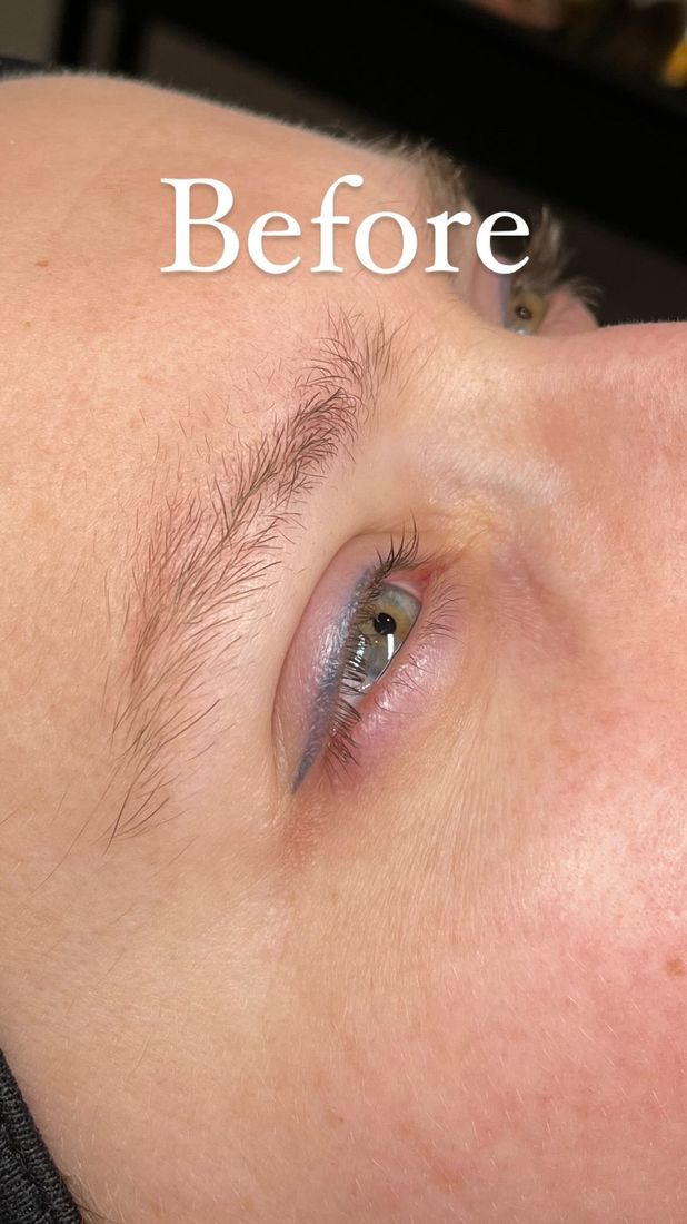 Wenkbrauwen: voor, Bellasura Clinic Sliedrecht